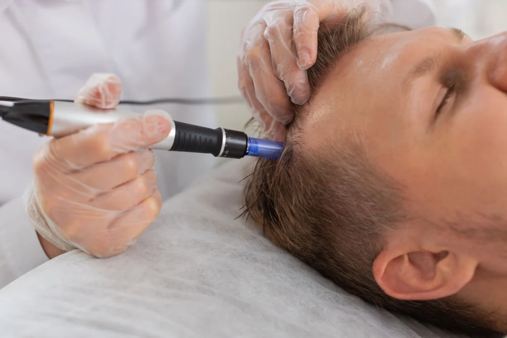 Hair Restoration with Exosomes in Olympia, WA | Rejuvenate Wellness Center