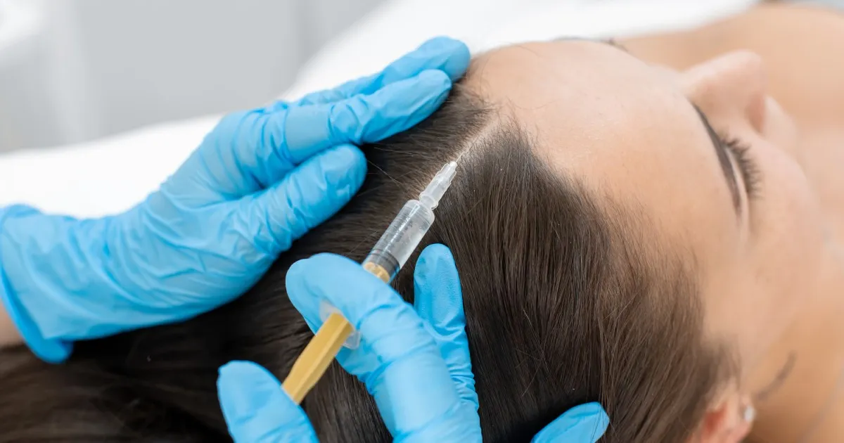 Women receiving Hair Restoration with Exosomes in Olympia, WA