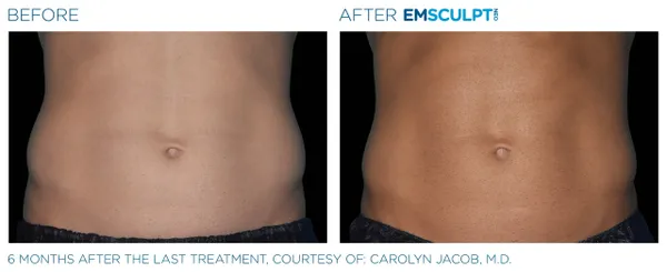 a comparison of a man's stomach - 2rs=w_600,cg_true,m