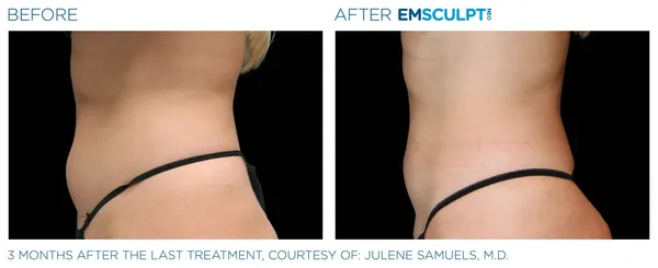 a comparison of a woman's body - 3rs=w_600,cg_true