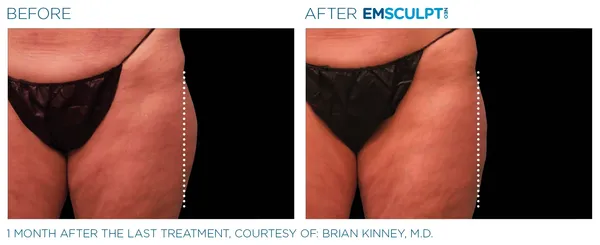 a comparison of a woman's body - 4rs=w_600,cg_true