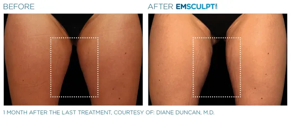 a comparison of skin and body - 5rs=w_600,cg_true,m