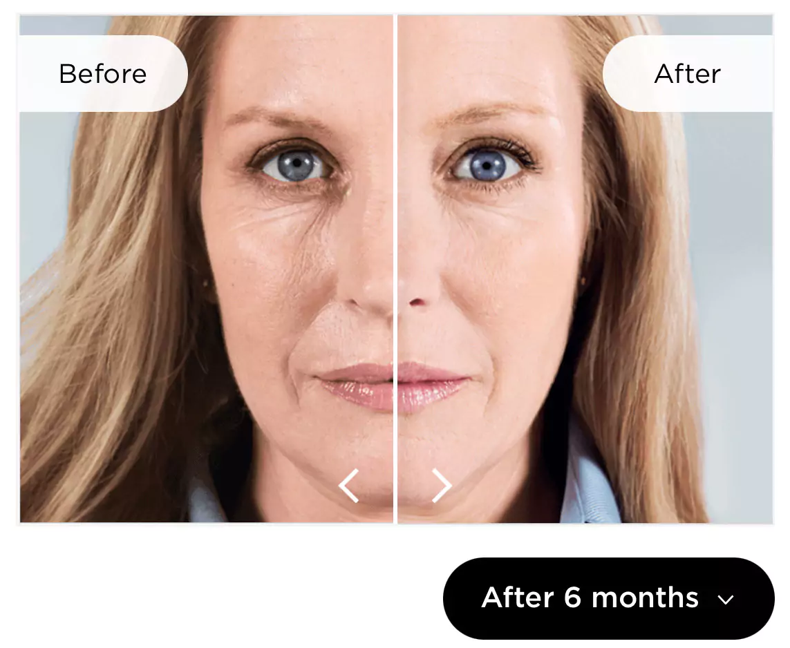 a woman's face before and after - image-123650291-666c6a5b07ac9