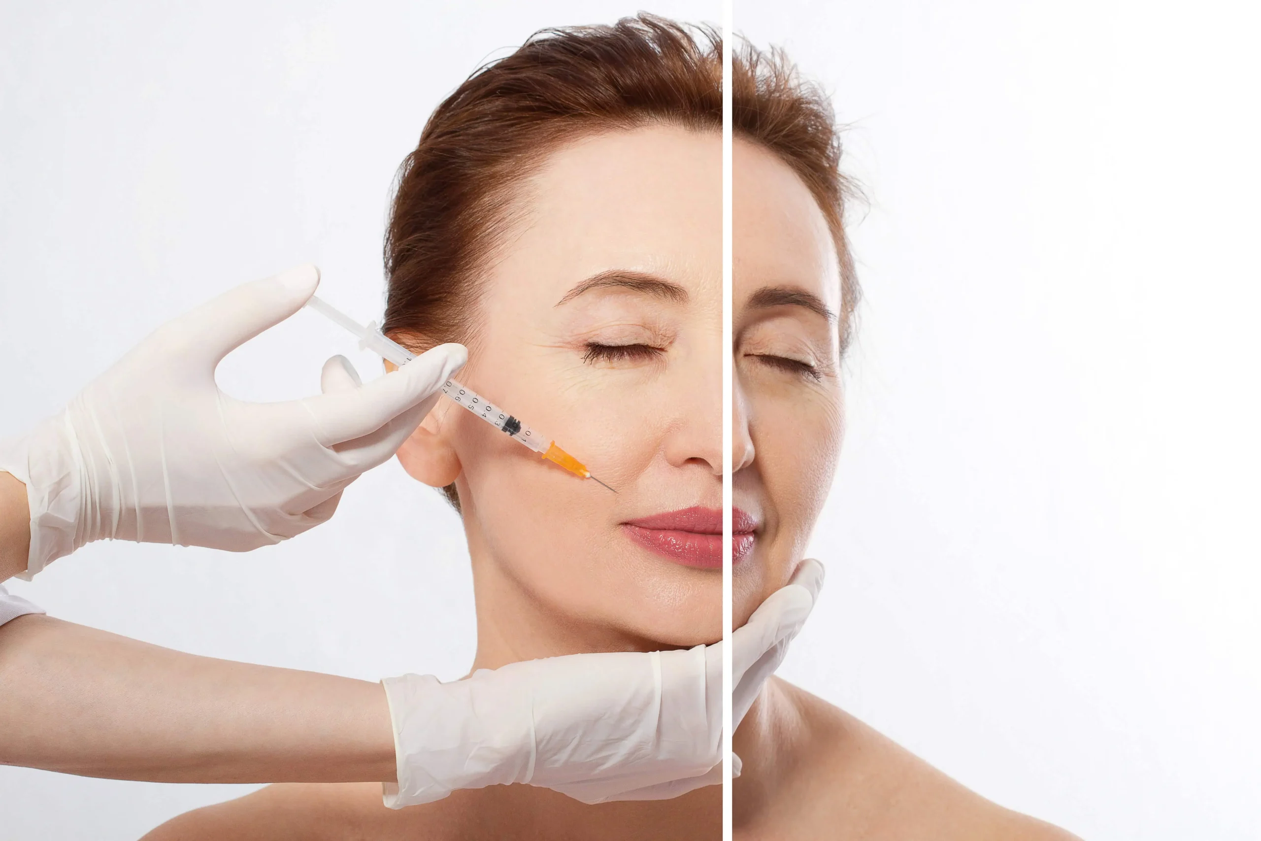 Dysport Injectables In Olympia, WA: Rejuvenate Wellness Center