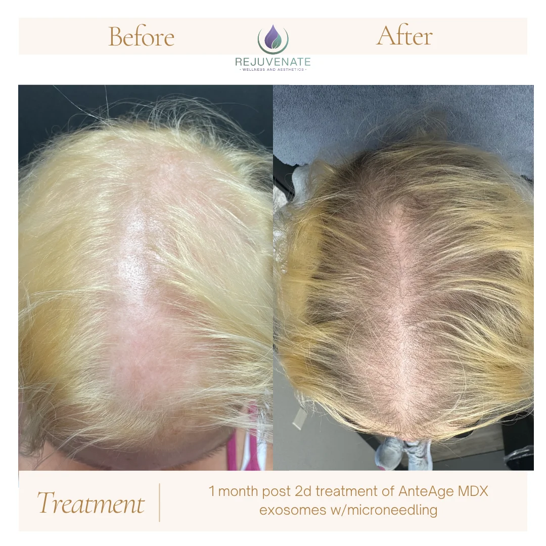 Neutral Before and After